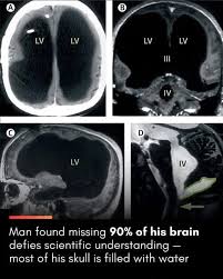 Image result for no brain