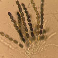 Attēlu rezultāti vaicājumam “Arcyria, Heterotrichia sp.”