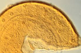 Attēlu rezultāti vaicājumam “Ombrophila violacea spores”