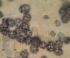 Attēlu rezultāti vaicājumam “Badhamiopsis scripta spores”