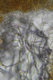 Attēlu rezultāti vaicājumam “Diderma rufostriatum”