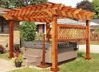 pre engineered pergola kits