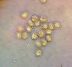 Attēlu rezultāti vaicājumam “Lycogala cf. fossiculatum sessile”