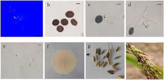 Attēlu rezultāti vaicājumam “Cribraria martinii spores”