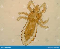 Attēlu rezultāti vaicājumam “Pediculus humanus capitis”