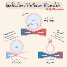 Image result for  v    q