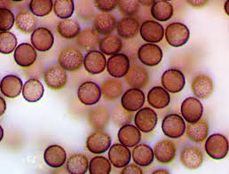 Attēlu rezultāti vaicājumam “Lycogala cf. oleocrystalliferum”