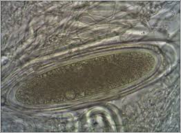 Attēlu rezultāti vaicājumam “Pertusaria pertusa”