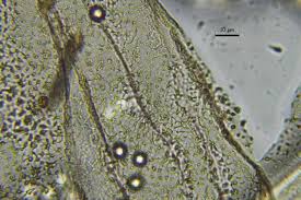 Attēlu rezultāti vaicājumam “Arcyria incarnata macro”