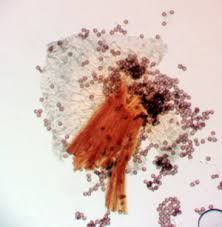 Attēlu rezultāti vaicājumam “Physarum braunianum young”