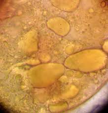 Attēlu rezultāti vaicājumam “Lycogala ustulatum macro”