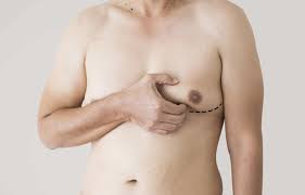 Image result for manboobs