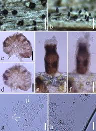 Attēlu rezultāti vaicājumam “Micarea sp.”