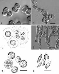 Attēlu rezultāti vaicājumam “Micarea sp.”