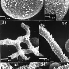 Attēlu rezultāti vaicājumam “Heterotrichia pomiformis (syn. Arcyria pomiformis) spores”