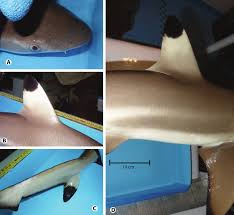 Image result for Carcharhinus melanopterus