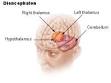 Hypothalamus - Wikipedia, the free encyclopedia