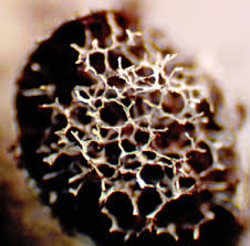 Attēlu rezultāti vaicājumam “Badhamiopsis scripta spores”