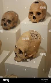 Image result for elongated skulls