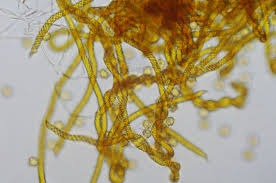 Attēlu rezultāti vaicājumam “Oligonema affine spores”