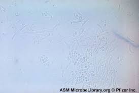 Attēlu rezultāti vaicājumam “Badhamia versicolor spores”