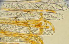 Attēlu rezultāti vaicājumam “Byssonectria fusispora”