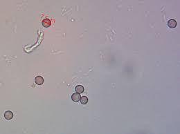 Attēlu rezultāti vaicājumam “Lycogala cf. fossiculatum”