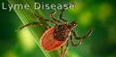 IDSA : Lyme Disease