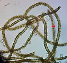 Attēlu rezultāti vaicājumam “Heterotrichia obvelata (syn. Arcyria obvelata) young”