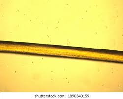 Image result for human hair microscope image