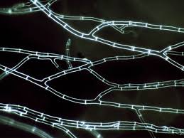 Attēlu rezultāti vaicājumam “Sordaria fimicola”