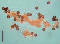 Attēlu rezultāti vaicājumam “Physarum cinereum spores”
