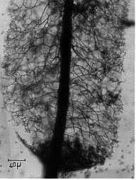Attēlu rezultāti vaicājumam “Stemonitopsis aequalis var. microspora spores”