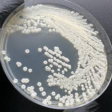 Attēlu rezultāti vaicājumam “Comatricha fragilis spores”