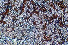 Attēlu rezultāti vaicājumam “Dictydiaethalium plumbeum young”