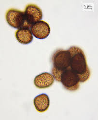 Attēlu rezultāti vaicājumam “Badhamia foliicola spores”