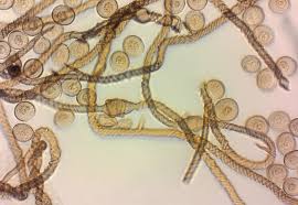 Attēlu rezultāti vaicājumam “Hemitrichia karstenii”