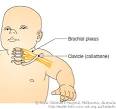 <b>Obstetric</b> brachial plexus