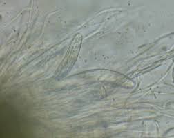 Attēlu rezultāti vaicājumam “Neocudoniella albiceps”