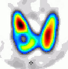 http://t0.gstatic.com/images?q=tbn:ANd9GcRbN2VEyblQ9NVgC-y9WwDXjdrwwfHXx8dYd4Z57aHord-0ynf5