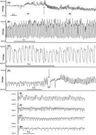 Attēlu rezultāti vaicājumam “Adelges laricis nymph”