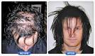 DermMatch Hair Loss Concealer - Customer Photos
