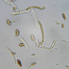 Attēlu rezultāti vaicājumam “Calicium salicinum”