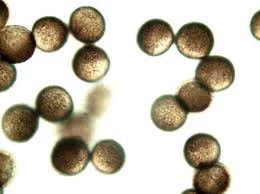 Attēlu rezultāti vaicājumam “Amaurochaete atra macro”