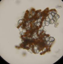 Attēlu rezultāti vaicājumam “Trentepohlia sp.”