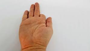 Znalezione obrazy dla zapytania palec