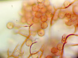 Attēlu rezultāti vaicājumam “Stemonitopsis amoena”