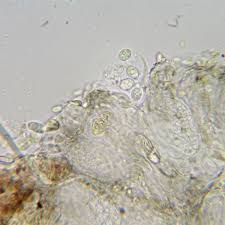 Attēlu rezultāti vaicājumam “Micarea sp.”