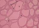 MICROSCOPIC HISTOLOGY IMAGES - ENDOCRINE SYSTEM - THYROID GLAND ...
