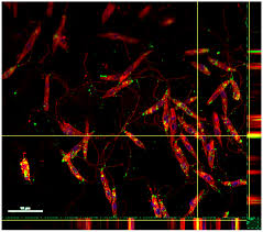 Attēlu rezultāti vaicājumam “Leiocolea rutheana cells”